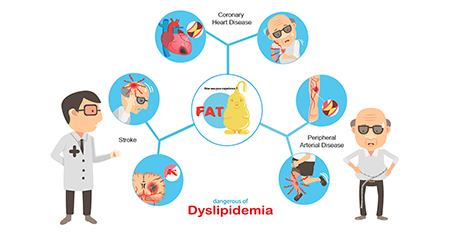 دیس لیپیدمی, علائم دیس لیپیدمی,راههای تشخیص بیماری دیس لیپیدمی