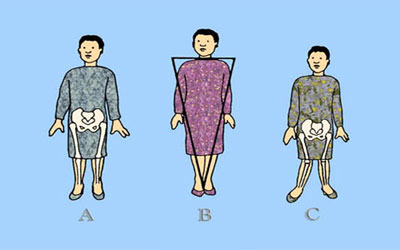 ناهنجاری قامتی,نحوه صحیح ایستادن,ناهنجاری های اسکلتی