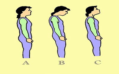 ناهنجاری قامتی,نحوه صحیح ایستادن,ناهنجاری های اسکلتی