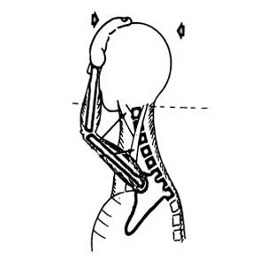 ورزش درمانی,حرکات اصلاحی برای ناهنجاری سر به جلو,تمرینات ورزشی