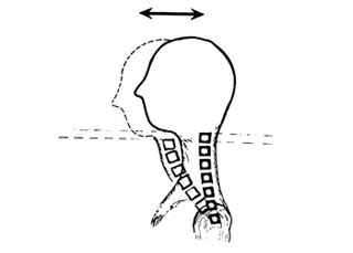 ورزش درمانی,حرکات اصلاحی برای ناهنجاری سر به جلو,تمرینات ورزشی