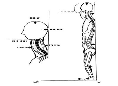ورزش درمانی,حرکات اصلاحی برای ناهنجاری سر به جلو,تمرینات ورزشی