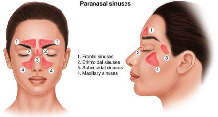 سینوس‌های پارانازال چیست, عفونت سینوس‌های پارانازال