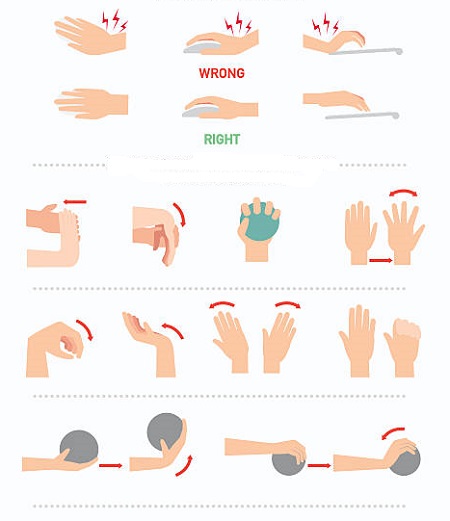 فیزیوتراپی تاندون مچ دست آسیب دیده, کشیدگی تاندون مچ دست, ورزش آسیب دیدگی تاندون مچ دست