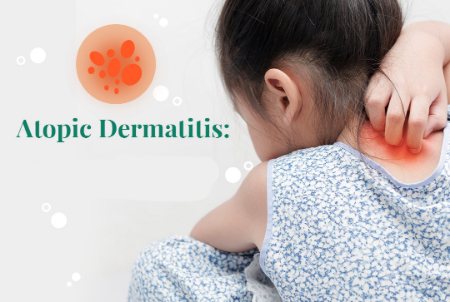 عوامل تشدید درماتیت آتوپیک, محرک‌های اگزما